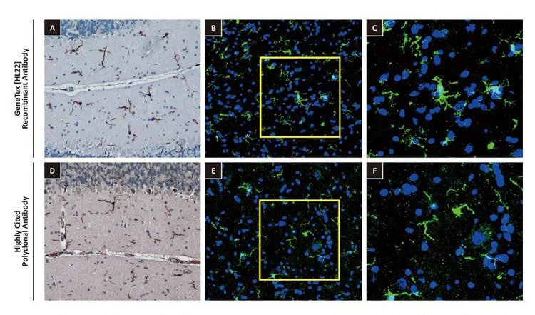 Iba1 antibody [HL22]