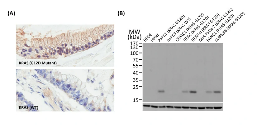RAS (G12D mutant) antibody [HL10]