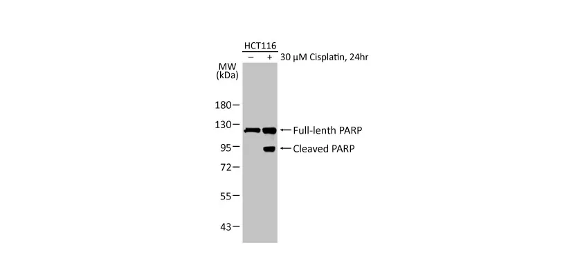 PARP antibody [HL1364] (GTX636804)