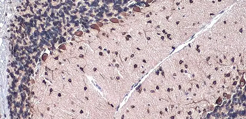 Gli1 antibody [HL247] (GTX635619)