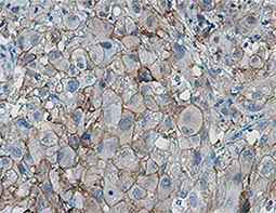 PD-L1 antibody