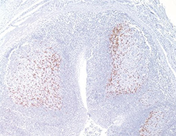PD-1 antibody(GTX20256)