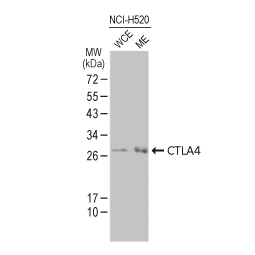 CTLA4 antibody [HL2732]