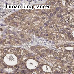 LDHA antibody [HL2615]