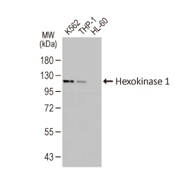 Hexokinase 1 antibody [HL6256]