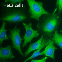 PKM antibody [GT1810]