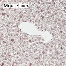 KDM4A antibody [HL6181]
