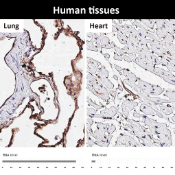 ICAM1 / CD54 antibody [HL4447]