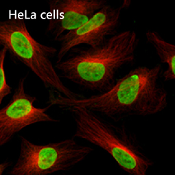 ZEB1 antibody [HL2245]