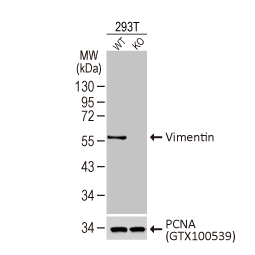 Vimentin antibody [HL1506]