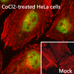 HIF2 alpha antibody [GT125]