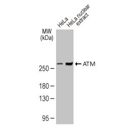 ATM antibody [2C1-RB]