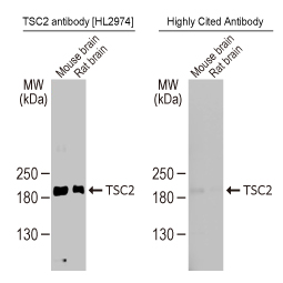 TSC2 antibody [HL2974]