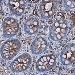 C Reactive Protein antibody (GTX101262)