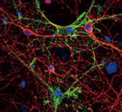 Aquaporin 4 antibody