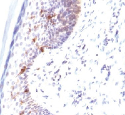 CD1a antibody (GTX34471)
