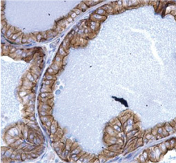Cytokeratin 5 antibody(GTX113219)