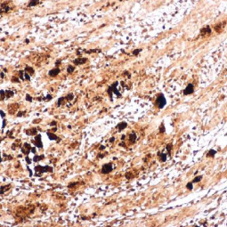 Enterovirus 71 VP1 antibody (GTX132339) 