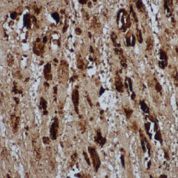 Enterovirus 71 VP2 antibody (GTX132340) 