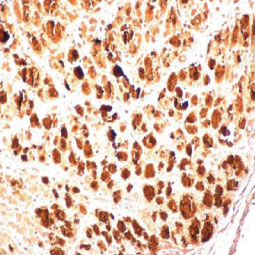 Enterovirus 71 3AB antibody (GTX132344) 