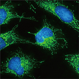 Hexokinase II antibody