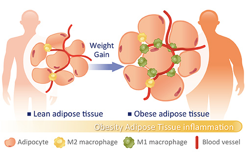 Obesity