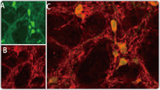 ASIC1 antibody (GTX54804)