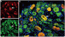 ASIC3 antibody (GTX54807)