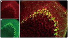 Cav3.2 antibody (GTX54813)