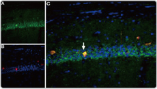 Nav1.6 antibody (GTX54842)