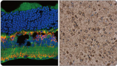 P2X7 antibody (GTX104288)
