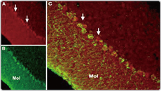 TRPC6 antibody (GTX54757)