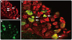 TRPV1 antibody (GTX54762)