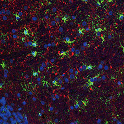 IL1 beta antibody