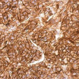 CD10 antibody [N2C1], Internal (GTX111680)