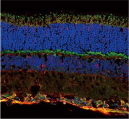 NMDAR1 antibody