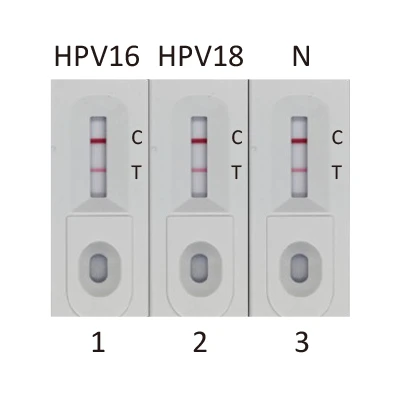 Human Papillomavirus type 16 E7