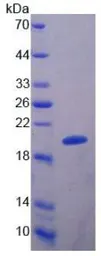 Rat SLIT2 protein, His tag. GTX00062-pro