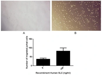 Human CCL21 protein, His tag (active). GTX00072-pro