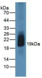 Human GM-CSF protein, His tag (active). GTX00082-pro