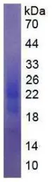 Human GM-CSF protein, His tag (active). GTX00082-pro