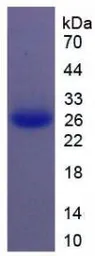 Human IL11 protein, His tag (active). GTX00087-pro