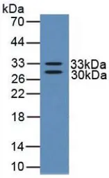 Human NGF protein, His tag (active). GTX00097-pro