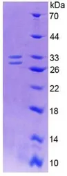 Human NGF protein, His tag (active). GTX00097-pro