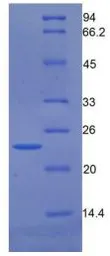 Human GAS6 protein, His tag (active). GTX00106-pro