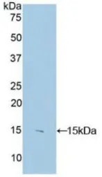 Human S100 beta protein, His tag. GTX00117-pro