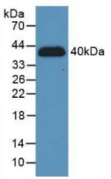 Human HIF1 alpha protein, His tag. GTX00119-pro