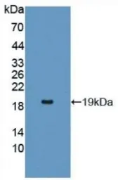 Human IL17 Receptor alpha protein, His tag. GTX00132-pro