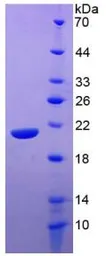 Human IL20 protein, His tag (active). GTX00137-pro