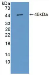 Human IL17D protein, His and GST tag. GTX00141-pro